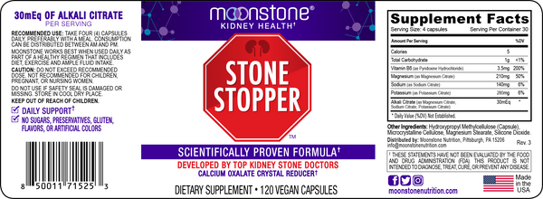 Stone Stopper Capsules (30 Servings)