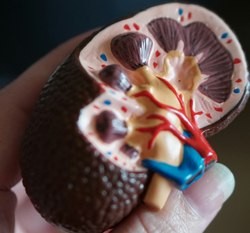 Cystine Kidney Stones: Why They Form and What Prevention Involves